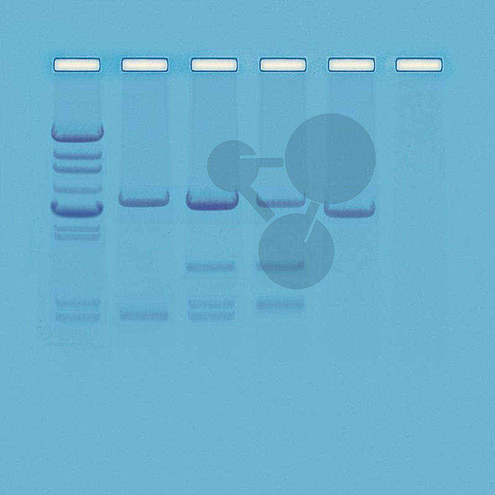 Test otcovství analýzou DNA
