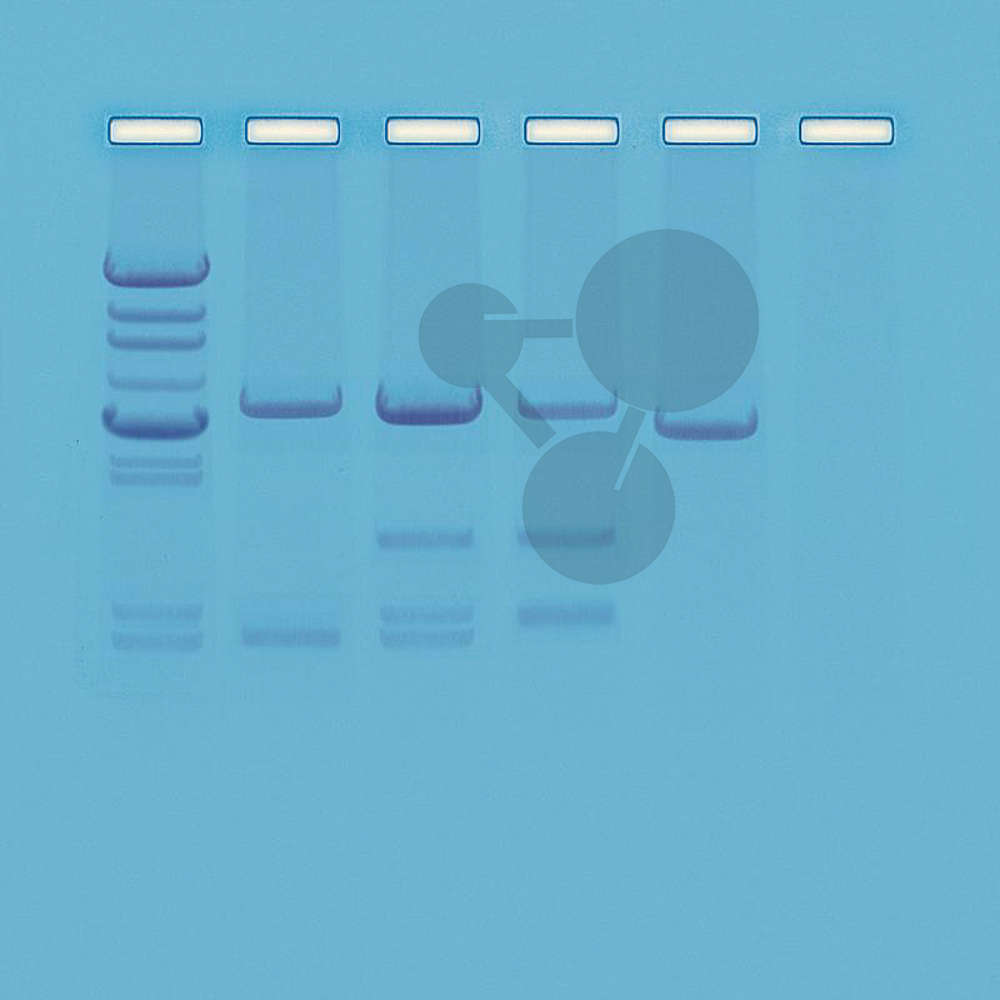 Test otcovství analýzou DNA