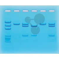 PCR test na COVID-19