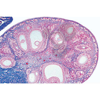 Histologie: pohlavní orgány Samice